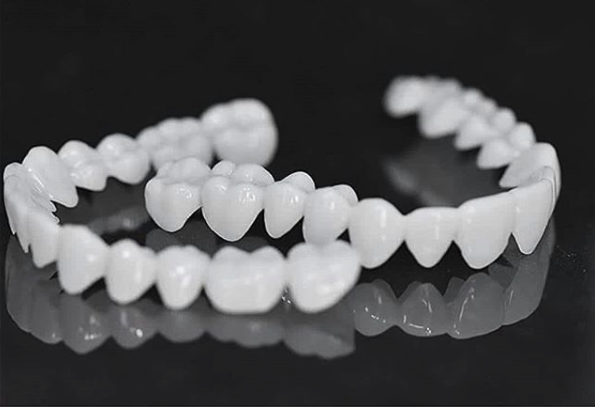 Tandenbeugel set – op maat – witte esthetiek – voor mooie glimlach