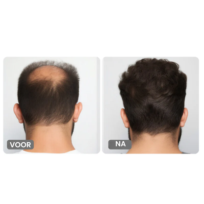 Haargroeiserum – Pipetdruppelaar – Root Activator Serum