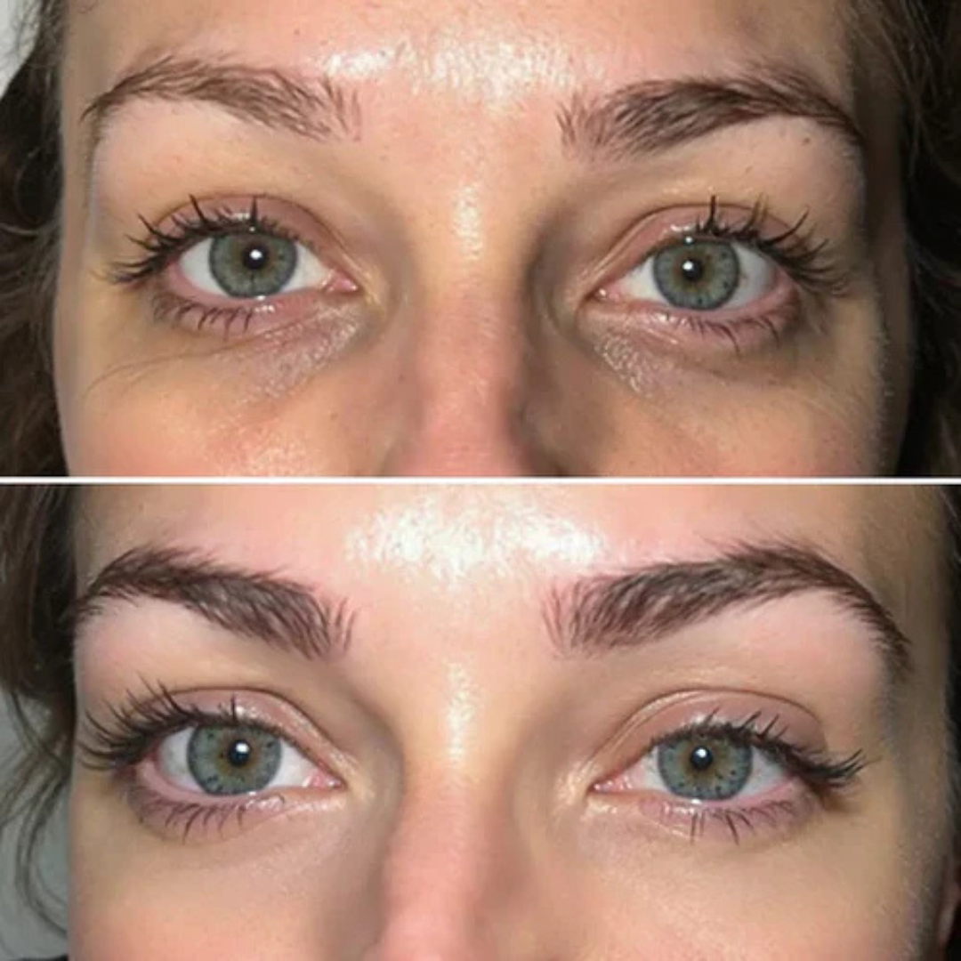 Oogpatches | Tegen Donkere Kringen, Vermoeidheid & Rimpels