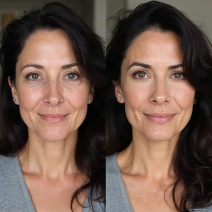 Oogpatches | Tegen Donkere Kringen, Vermoeidheid & Rimpels