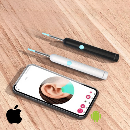 EarVision Pro Oorcamera met Licht & App | Voor eenvoudige & hygiënische oorreiniging