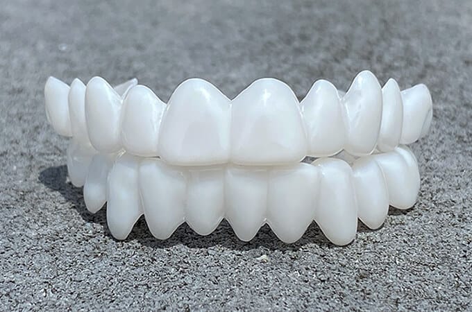 Tandenbeugel set – op maat – witte esthetiek – voor mooie glimlach