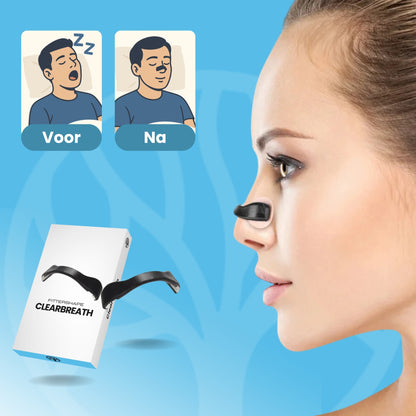 Fittershape ClearBreath | Neusstrips – Voor Vrije Ademhaling