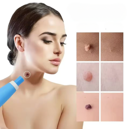 WratStop Steelwrat Verwijderaar | Pijnloos voor Gezicht & Lichaam