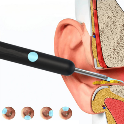 EarVision Pro Oorcamera met Licht & App | Voor eenvoudige & hygiënische oorreiniging