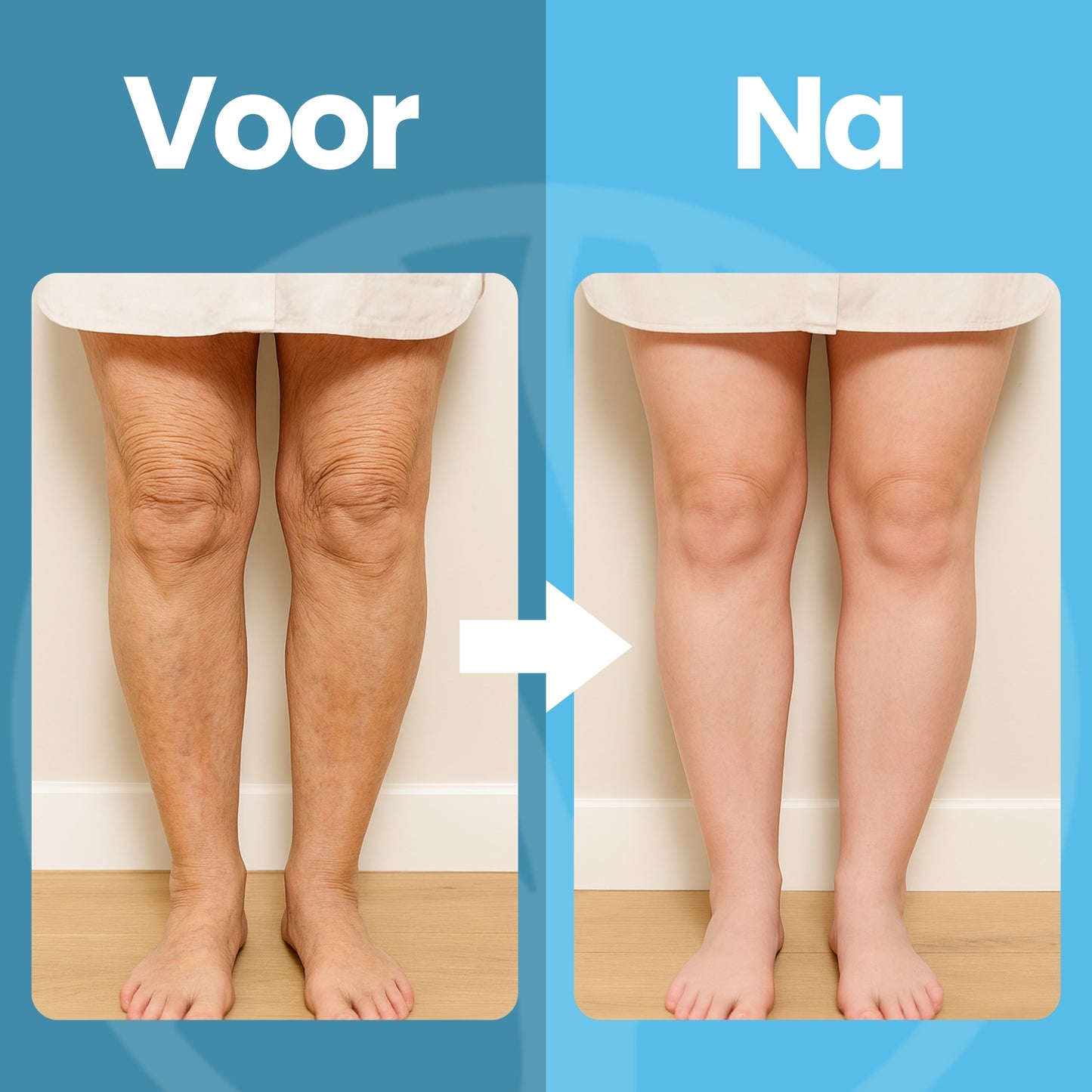 Fittershape EMS Voetmassage Apparaat