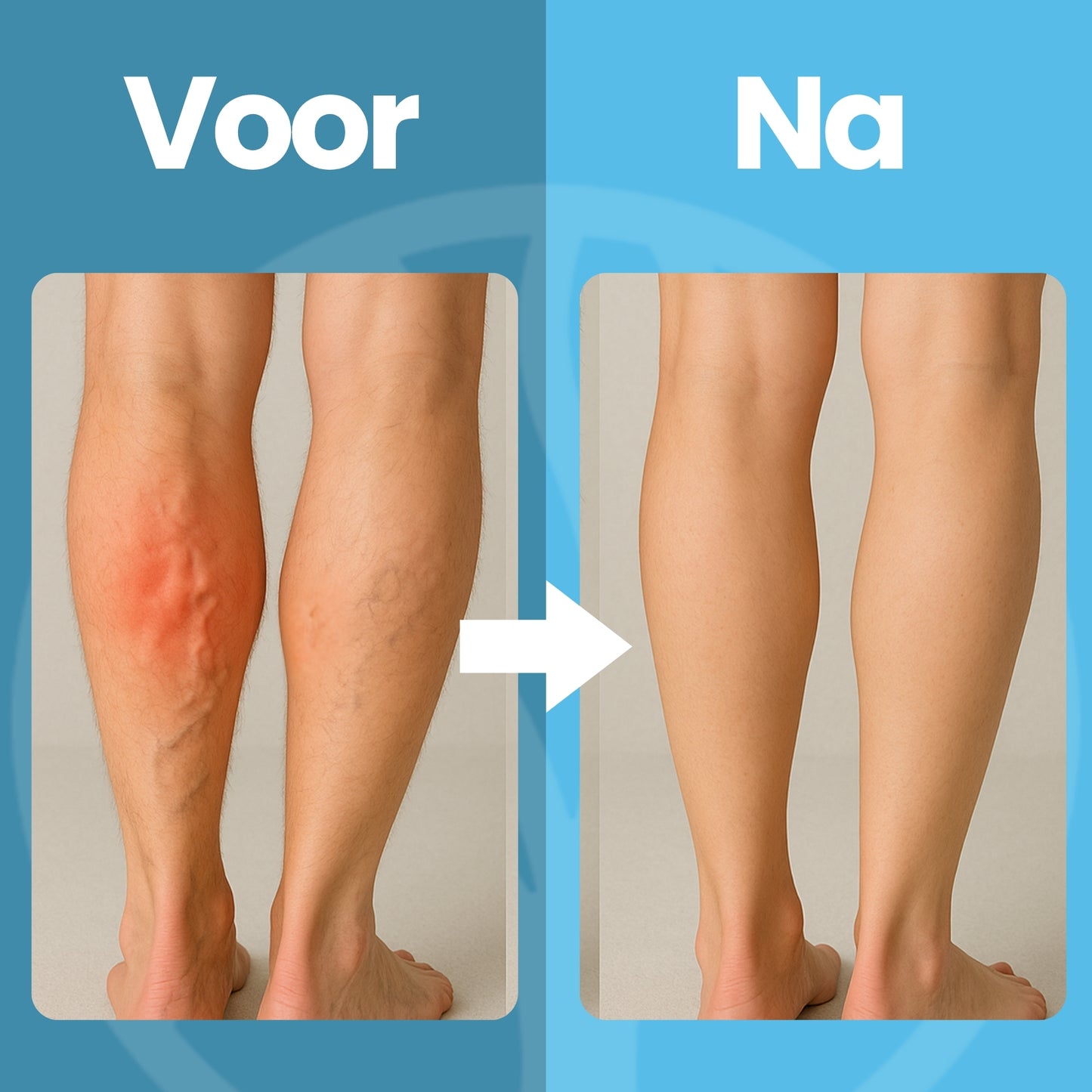 Fittershape CareFlow Compressiesokken