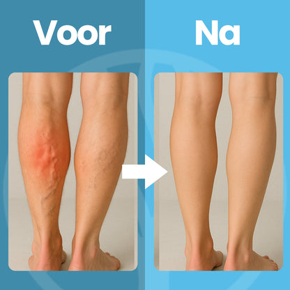 Fittershape CareFlow Compressiesokken