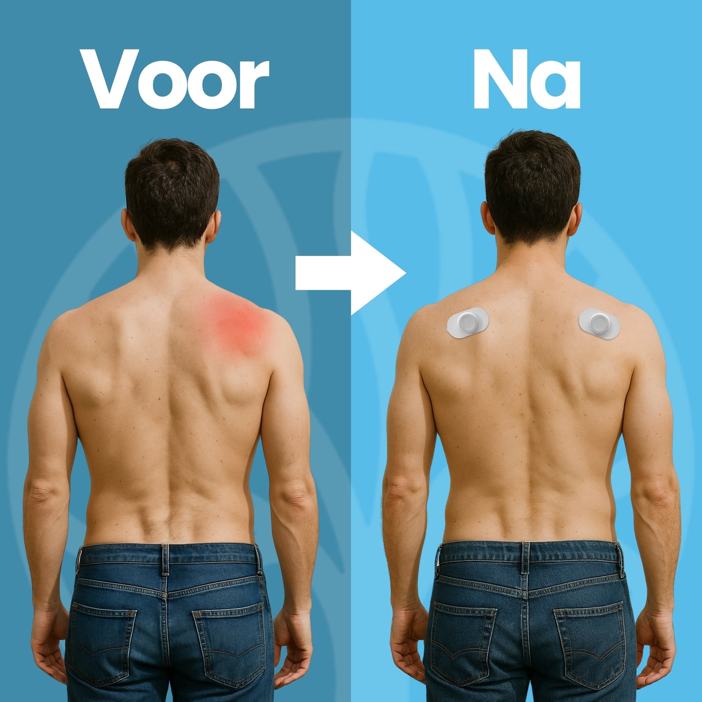 Fittershape ReliefPod