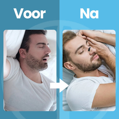 Fittershape ClearBreath | Neusstrips – Voor Vrije Ademhaling