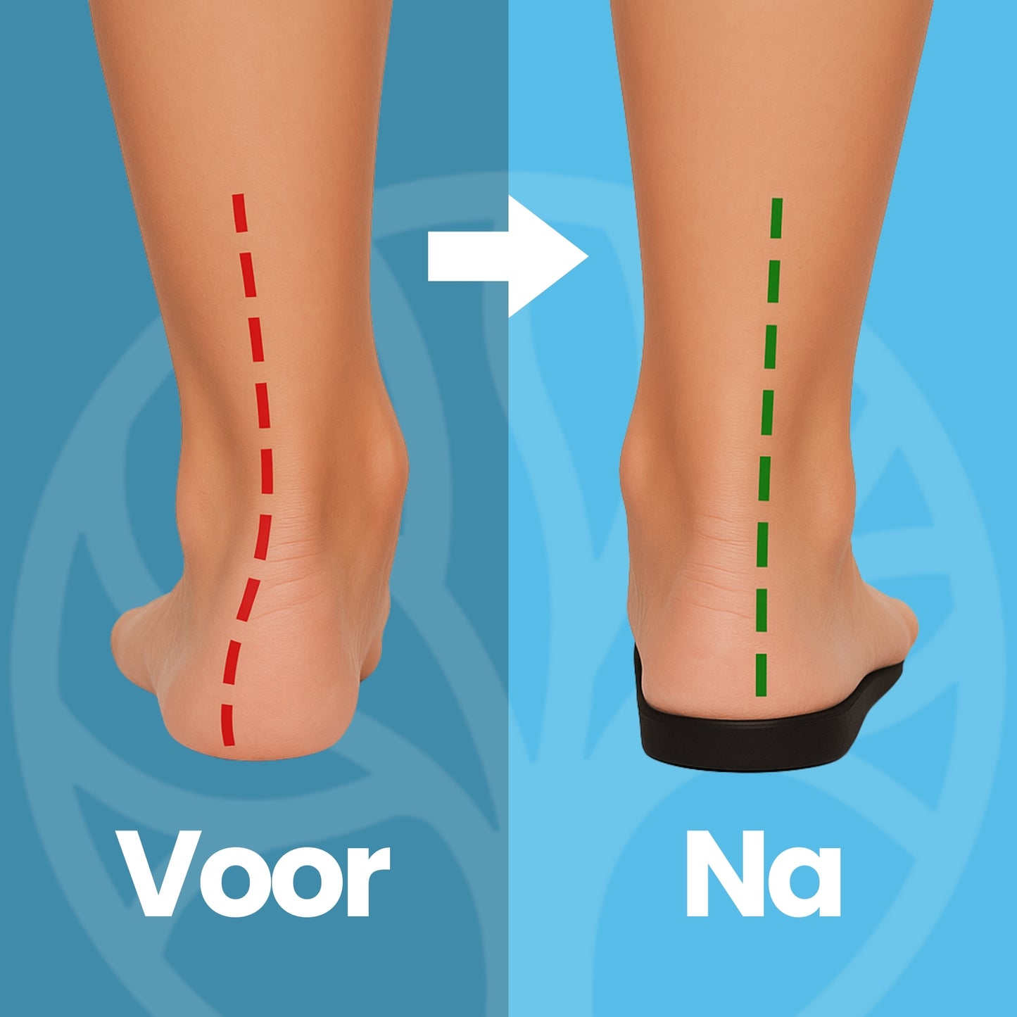 Fittershape ErgoStep Inlegzolen