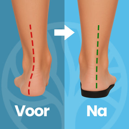 Fittershape ErgoStep Inlegzolen