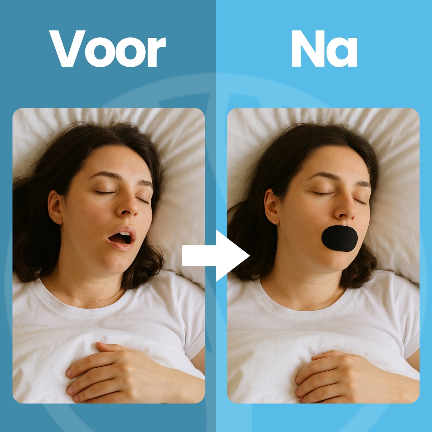 Fittershape SleepSeal | Mondslaap Tape – Voor Betere Neusademhaling
