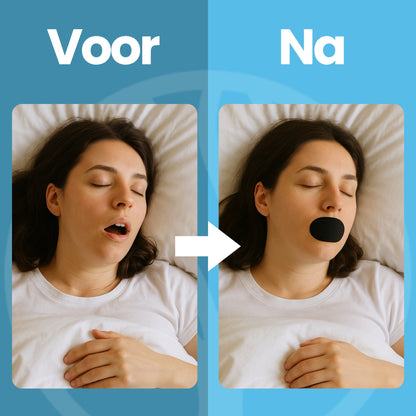 Fittershape SleepSeal | Mondslaap Tape – Voor Betere Neusademhaling