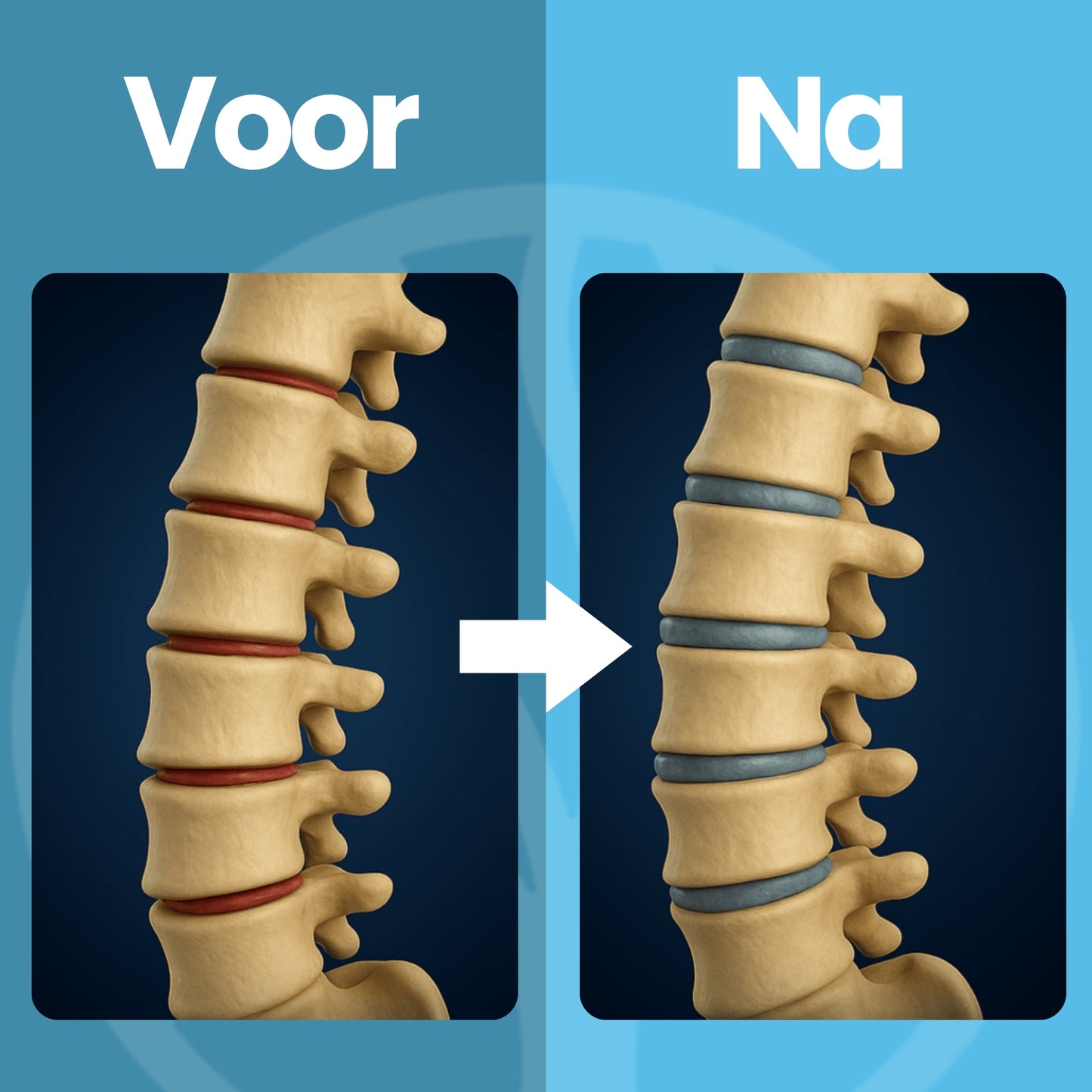 Fittershape DeepRelief