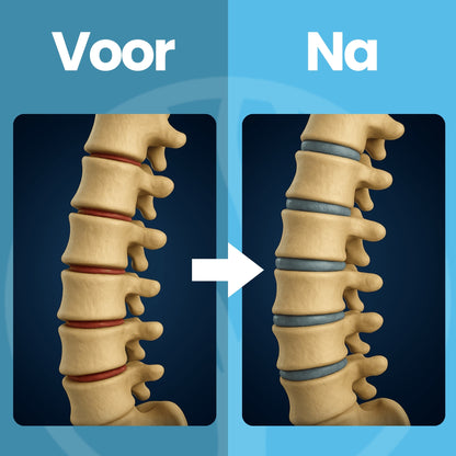 Fittershape DeepRelief