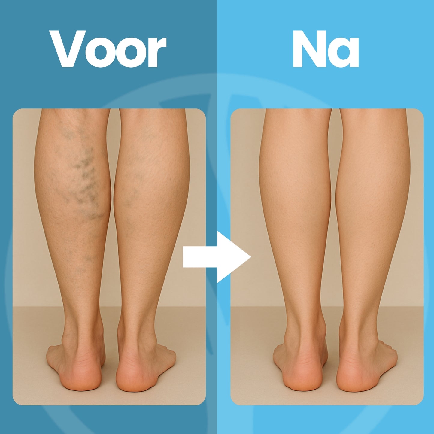 Fittershape CircuSupport Compressiekousen