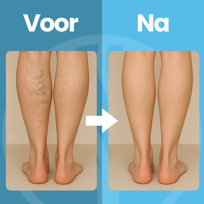 Fittershape CircuSupport Compressiekousen