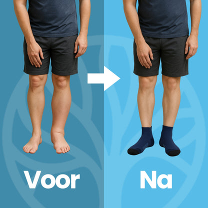 Fittershape Compress Pro