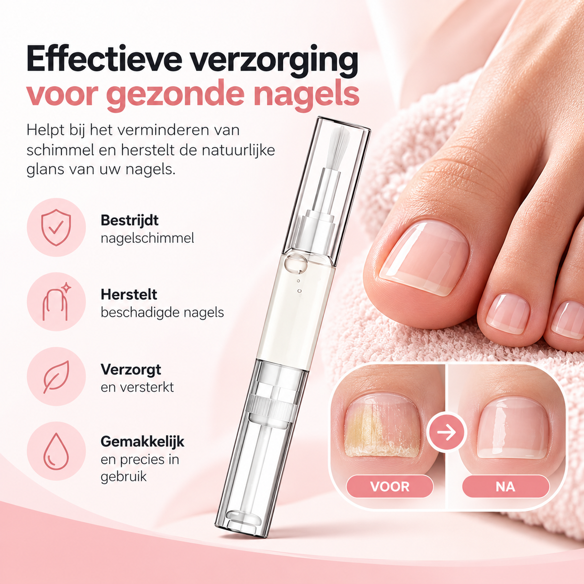 Fittershape Antifungal Pen – maximale sterkte tegen nagelschimmel