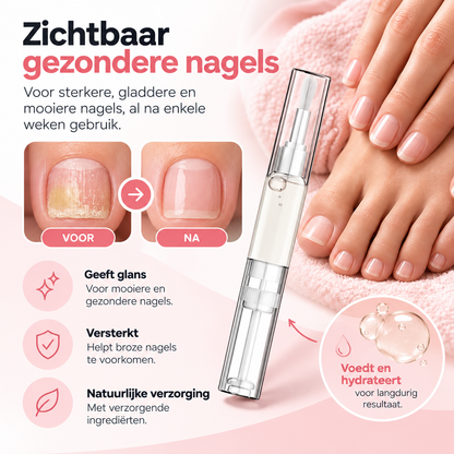 Fittershape Antifungal Pen – maximale sterkte tegen nagelschimmel