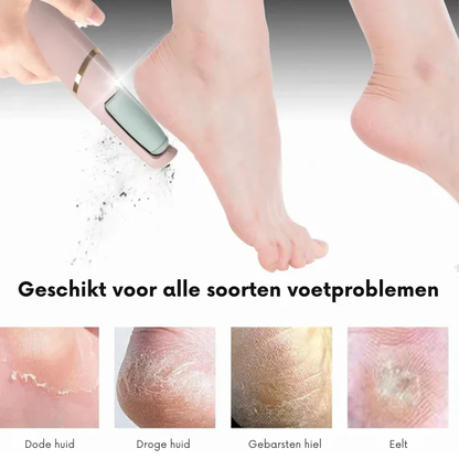 Voetvijl – Oplaadbaar – Verwijdert eelt – Voor zachte voeten
