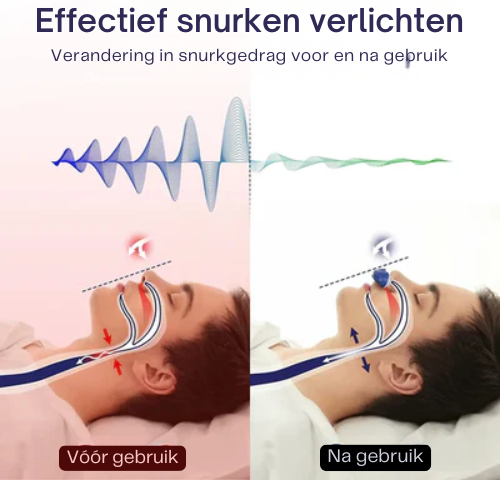 Slaap Snurkstopper – Oplaadbaar – Voor Beter Ademhalen – Voor Snurkers