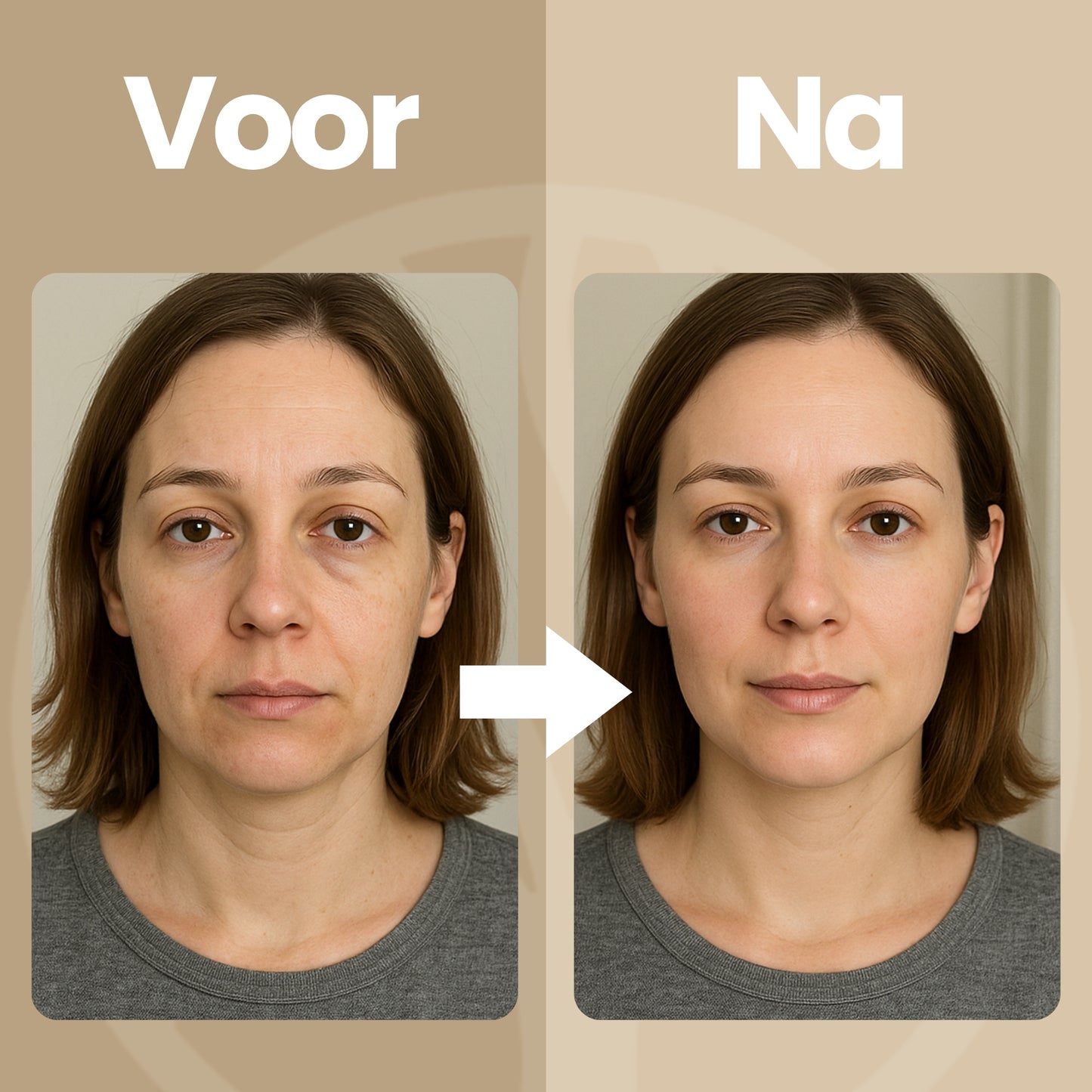 Fittershape GlowSculpt Wand | LED Gezichtstool – Voor Stevigere Huid