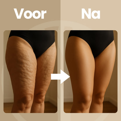 Fittershape CelluGlide Roller | Handmassager – Voor Gladde Huid & Betere Circulatie