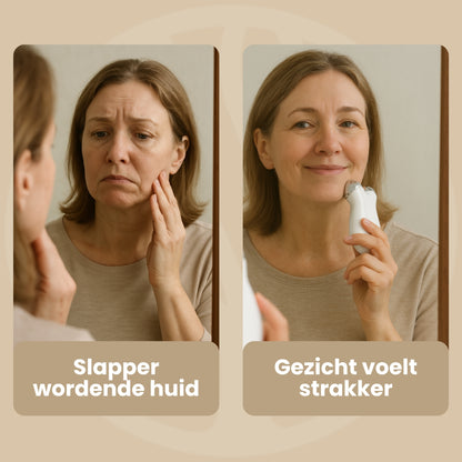 Fittershape GlowTone Wand | Microcurrent Gezichtstool – Voor Strakkere Huid
