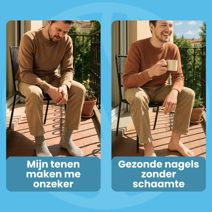 Fittershape Nail Renew | Lichttherapie Voor Gezonde Teennagels