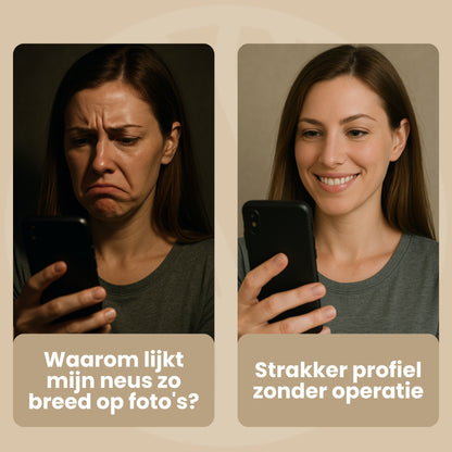 Fittershape NoseContour Clip | Voor Een Strakkere Neuslijn Zónder Operatie