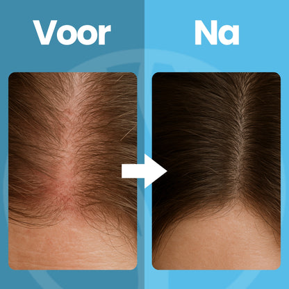 HairGlow Cap | Lichttherapie Muts – Voor Natuurlijke Haargroei