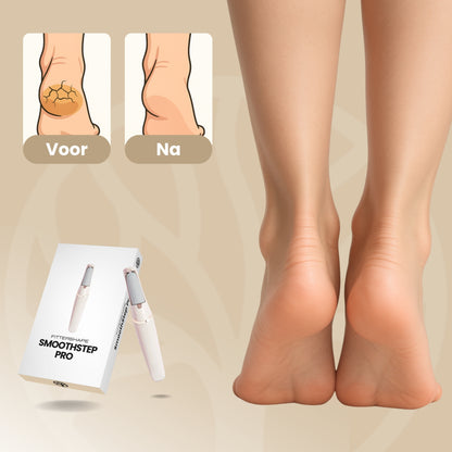 Fittershape SmoothStep Pro | Elektrische Voetvijl – Voor Gladde Hielen