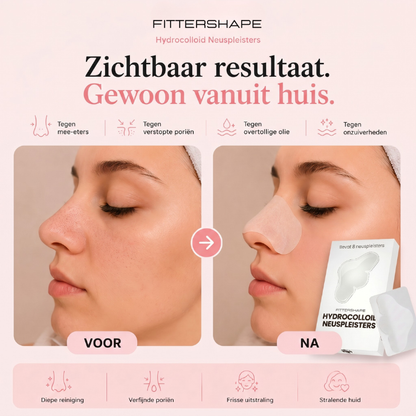 Fittershape Hydrocolloid Neuspleisters