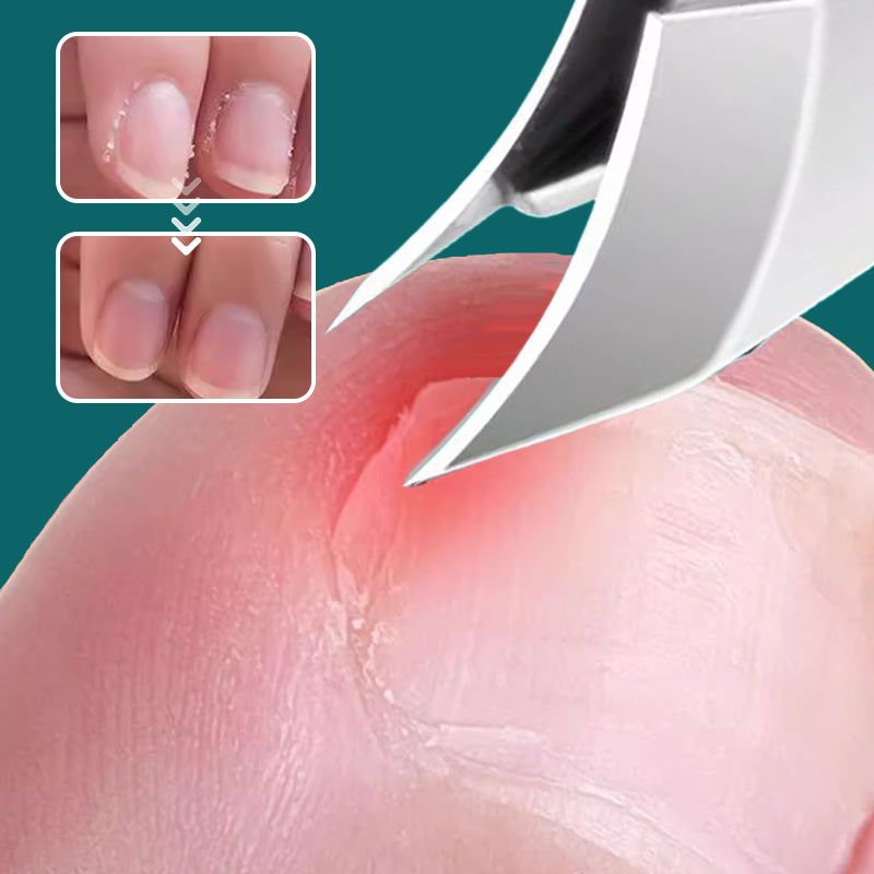 Professionele Nagelknipper Set – Rvs – Ergonomisch – Voor Nagelverzorging